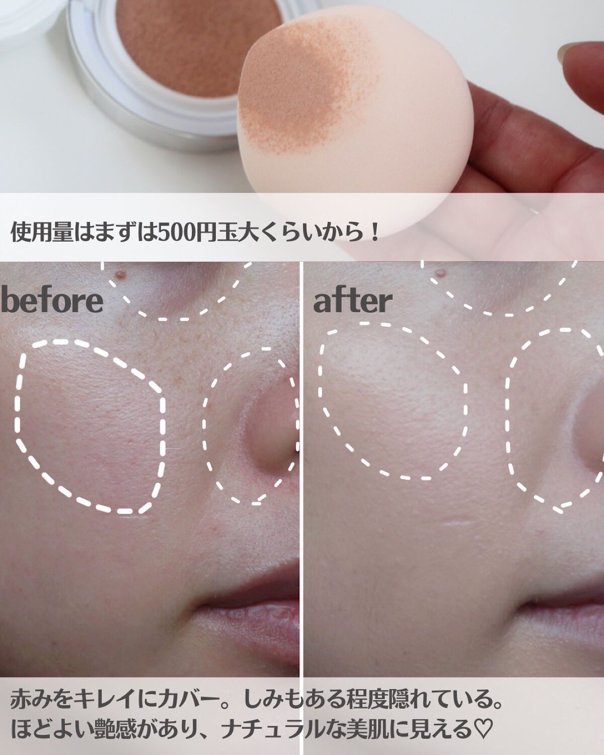 札幌さか子 on LIPS 「ドクターエルシア新作✨スリムフィットエバーラスティングクッショ..」(5枚目)