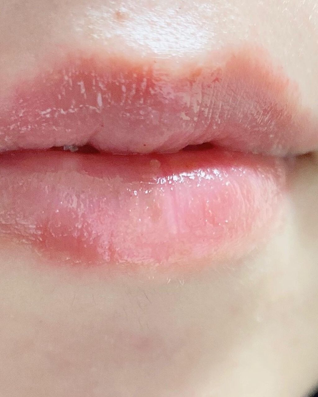  リップセラム プレミア /ceruru.b/リップ美容液を使ったクチコミ（3枚目）