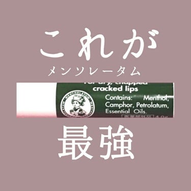 【これに尽きる。】

本気で唇直したい人、短期間で唇治したい人必見








こんにちはあんです！👶




私は最近唇がずっと荒れていて…😭
なかなか治らなくて困ってました😢

唇が荒れていると