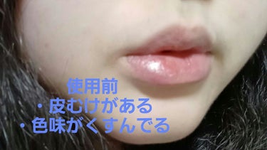 LIPSでお迎えした
カントリー＆ストリーム リップクリームHMのリアルレポートです！！
画像四枚目まで見ていただけると嬉しいです(*^^*)

唇のタイプ→乾燥しやすい、敏感、皮むけが良くある

どの薬用リップも合うのが少なくDHCさんの敏感肌用を今まで愛用し、匂いがきになっていたので大好きなはちみつのリップをみつけ購入を決めました！

使用感のまとめ👇🏻

・ハチミツやローヤルゼリーなどを多く含むとあるように甘い香りがぶわっと広がりハチミツ好き🍯❤な私のハートを鷲掴みにされました(❁´ω`❁)

・しっとりしているのにベタつきが少ない

・柔らかすぎず硬すぎないテクスチャーで塗りやすい！

※少しだけのデメリット👇🏻👇🏻※

・甘い匂いが苦手な方には不向きの場合がありそう

・乳幼児さんのママさんにはリスクがありそう(ハチミツが摂取できるお子さんの月齢ならリスクは少ないですがハチミツを使用されているため万が一食中毒がおこるリスクがありそう)

使用前後の唇画像を貼っています！購入の参考にどうぞ

#カントリー&ストリーム
#リップクリーム HM
#ハチミツ
#乾燥予防
#愛されリップ
# 第一印象UP作戦 

の画像 その2