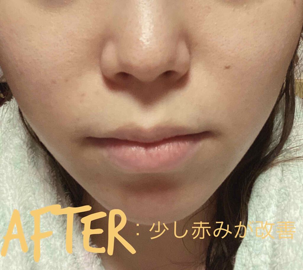 キャロットカロテン カーミングウォーターパッド/SKINFOOD/トナーパッドを使ったクチコミ(5枚目)