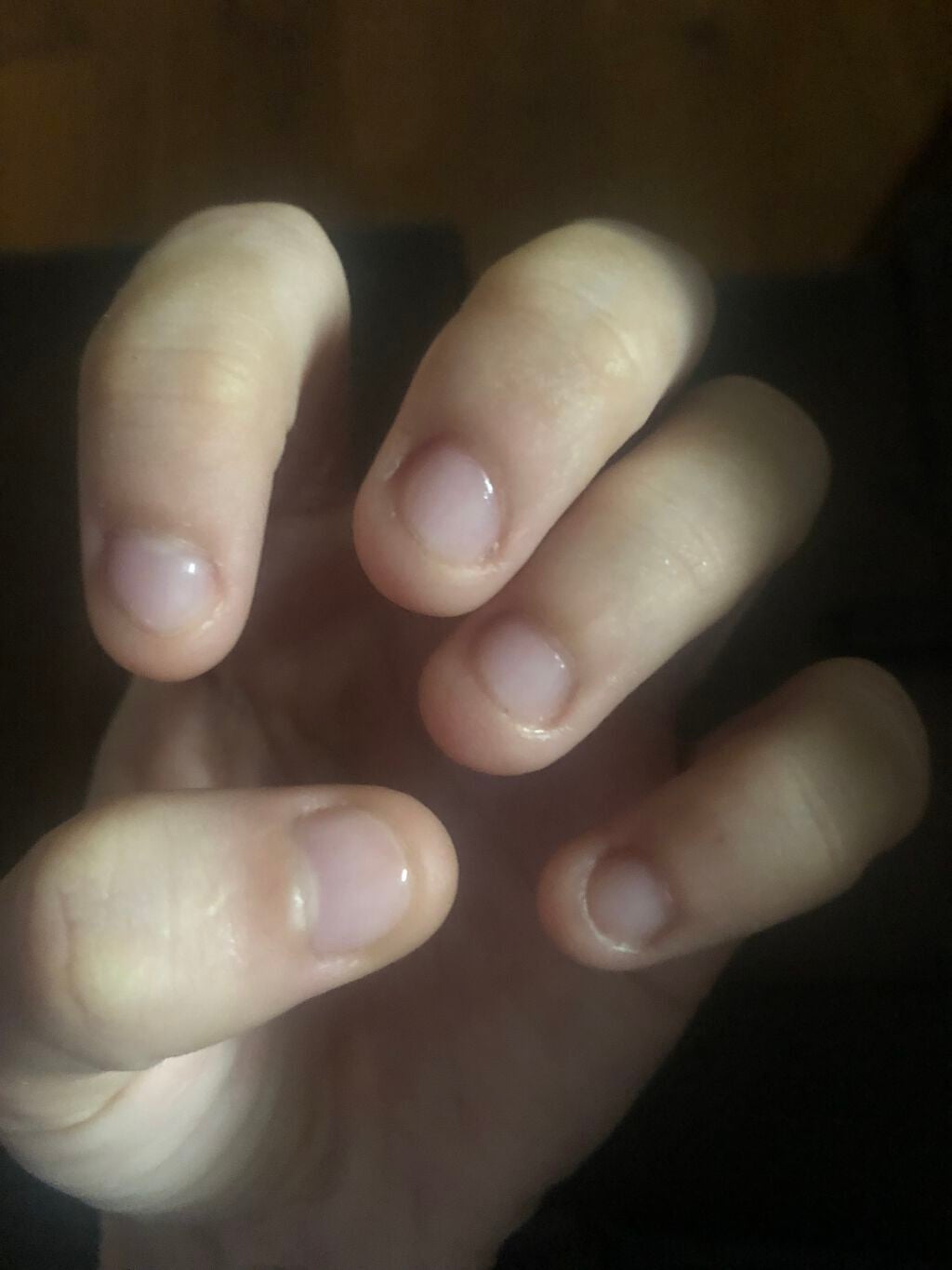 ネイルトリートメント N/ネイルネイル/ネイルオイル・トリートメントを使ったクチコミ(2枚目)