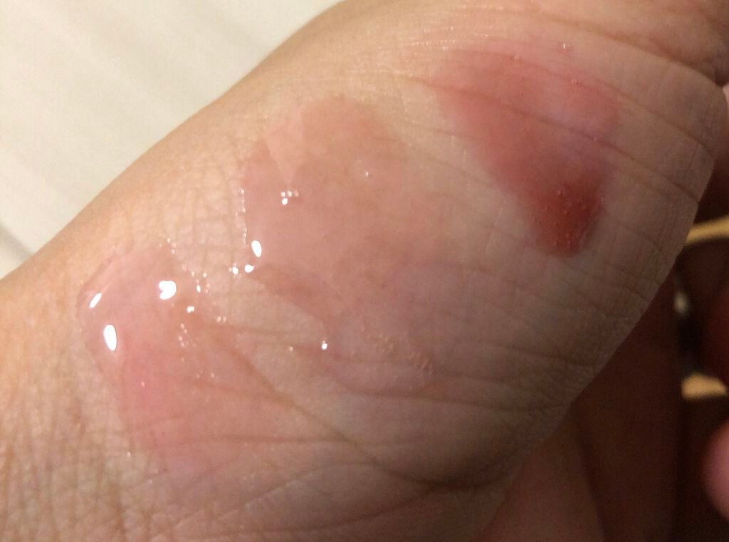 ディオール アディクト リップ グロウ オイル/Dior/リップグロスを使ったクチコミ(3枚目)