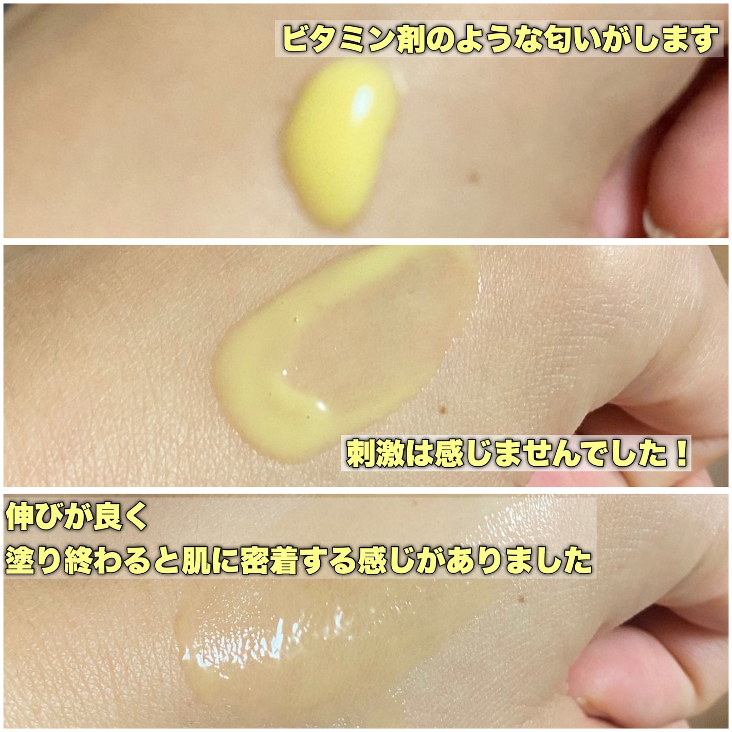 ãã£ãŒããã¿Cã¢ã³ãã«2.0/MEDICUBE/çŸå®¹æ¶²ã䜿ã£ãã¯ãã³ãïŒ4æç®ïŒ