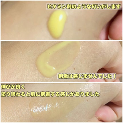 ãã£ãŒããã¿Cã¢ã³ãã«2.0/MEDICUBE/çŸå®¹æ¶²ã䜿ã£ãã¯ãã³ãïŒ4æç®ïŒ