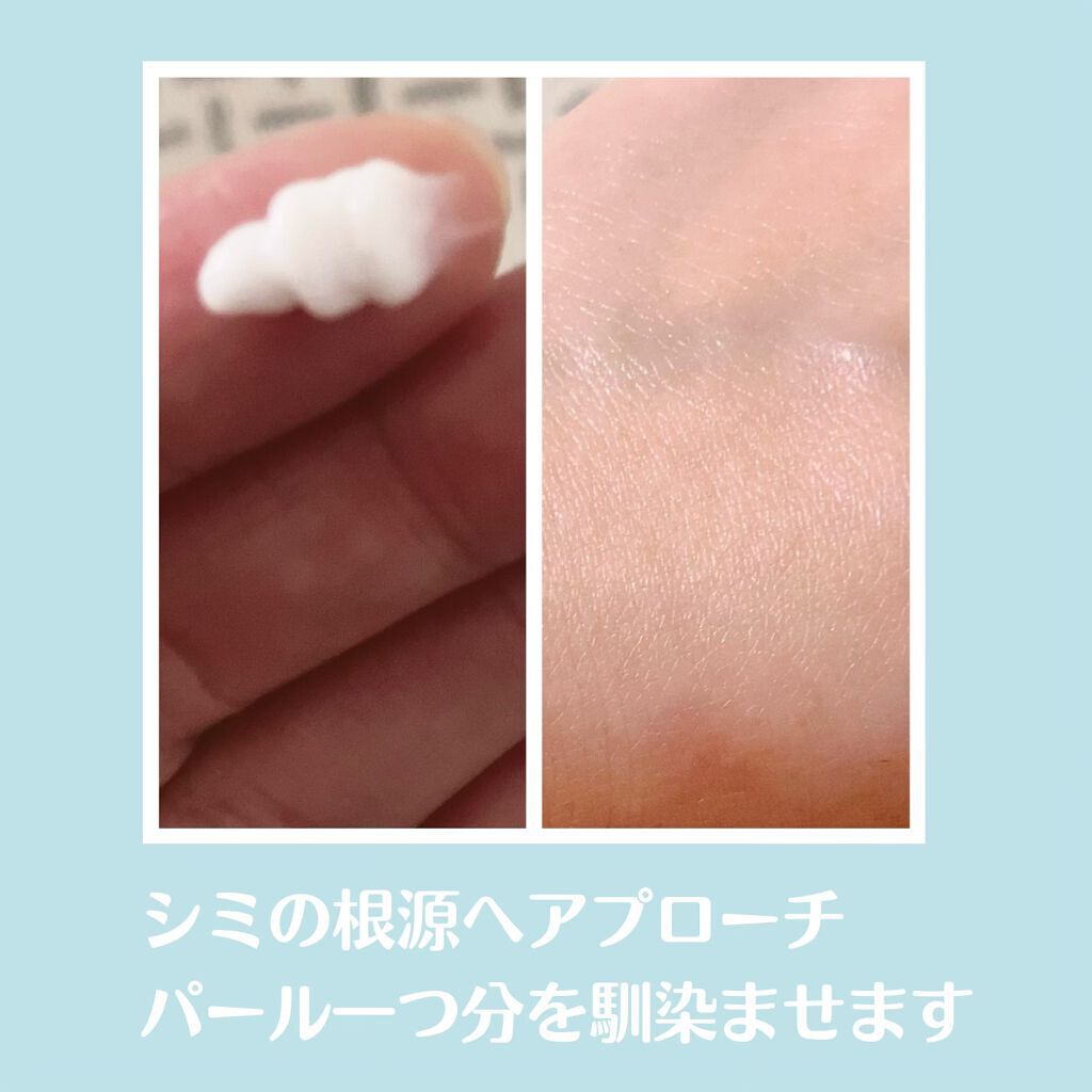 薬用ホワイトニングクリアローションEX/トランシーノ/化粧水を使ったクチコミ（3枚目）