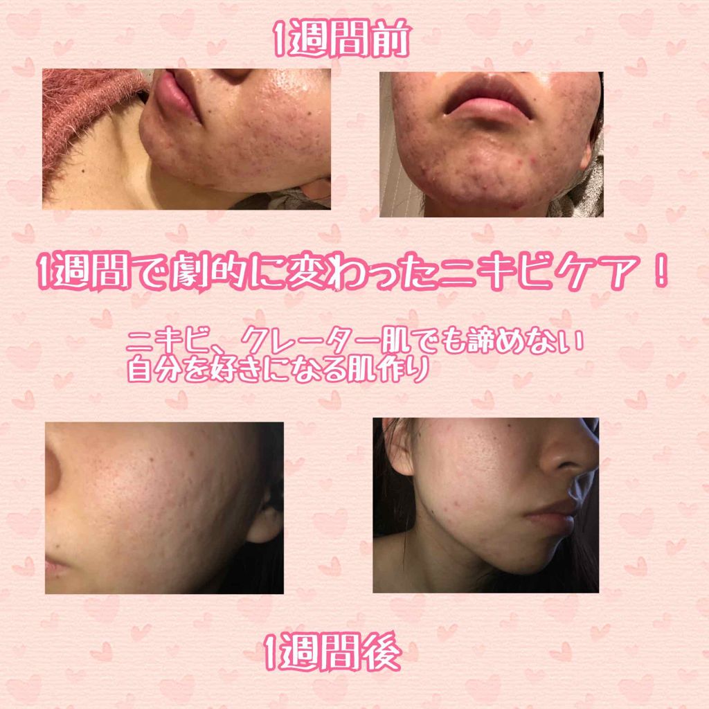 ソフティモ ホワイト クレンジングオイル/ソフティモ/オイルクレンジングを使ったクチコミ（1枚目）