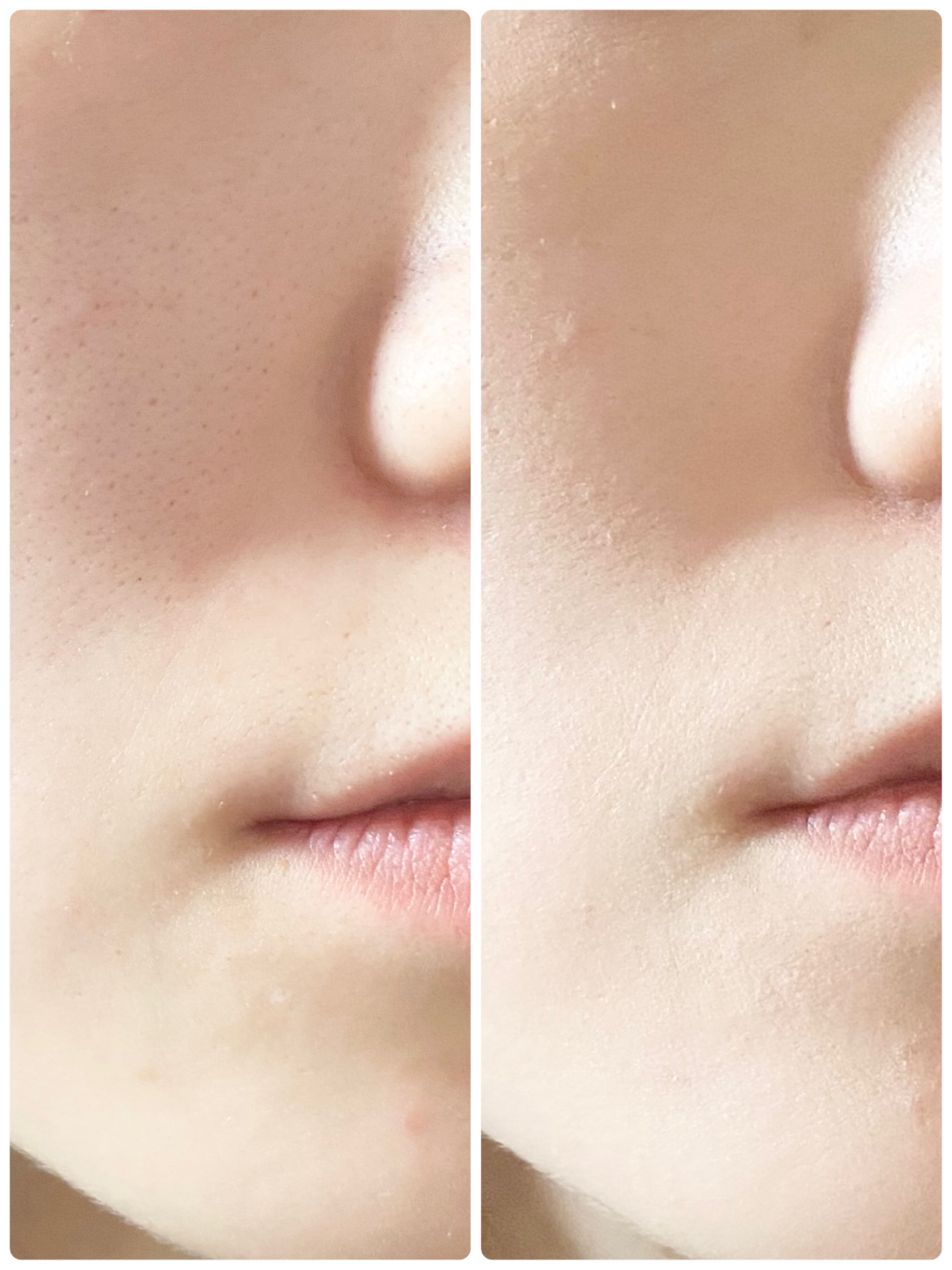 シピシピ フィットスキンクッション/CipiCipi/クッションファンデーションを使ったクチコミ（3枚目）