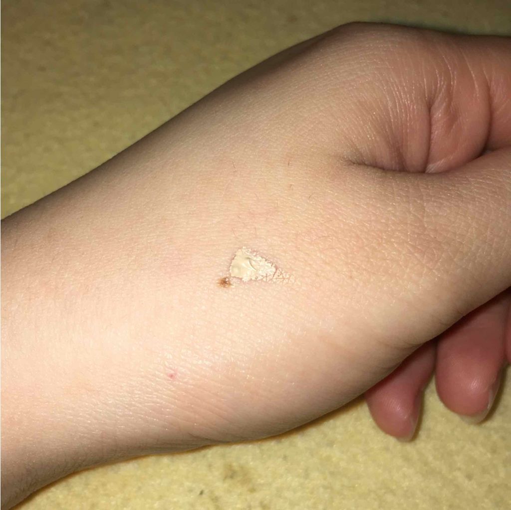 フルカバー/MAKE UP FOR EVER/クリームコンシーラーを使ったクチコミ（2枚目）