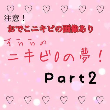 そらら🍀💭 on LIPS 「こんにちは！そららです☺︎今日はニキビ企画2日目の肌の状態と私..」（1枚目）