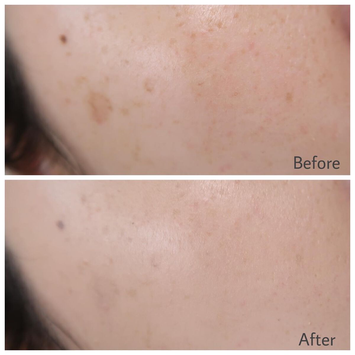 スーパーシカクッション/MEDICUBE/クッションファンデーションを使ったクチコミ(4枚目)