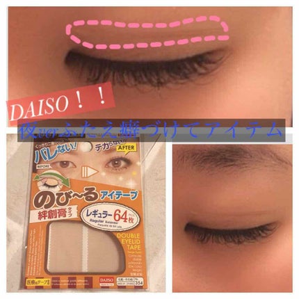 のびーるアイテープ(絆創膏タイプ、レギュラー)/DAISO/二重まぶた用アイテムを使ったクチコミ(1枚目)