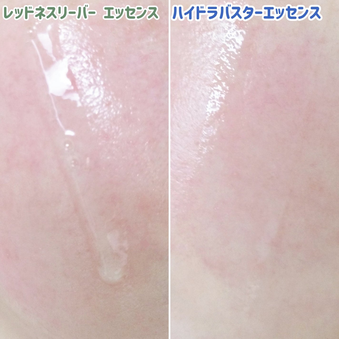 レッドネスリリーバー エッセンス/onoma/美容液を使ったクチコミ(6枚目)