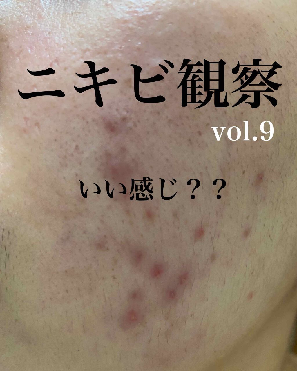 敏感肌用薬用美白美容液/無印良品/美容液を使ったクチコミ（1枚目）