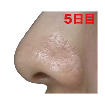 泥ジェル洗顔/ファンケル/その他洗顔料を使ったクチコミ(7枚目)