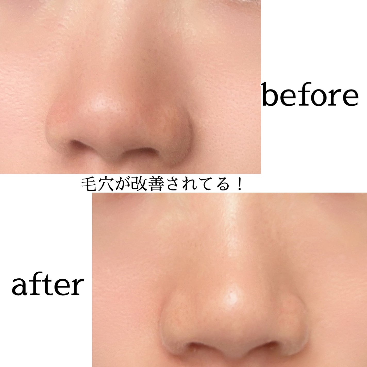 リードルショット300/VT/美容液を使ったクチコミ(3枚目)