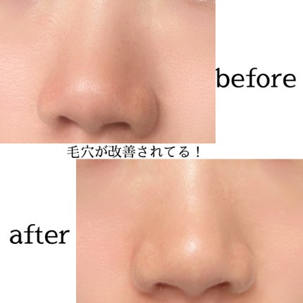 リードルショット300/VT/美容液を使ったクチコミ(3枚目)