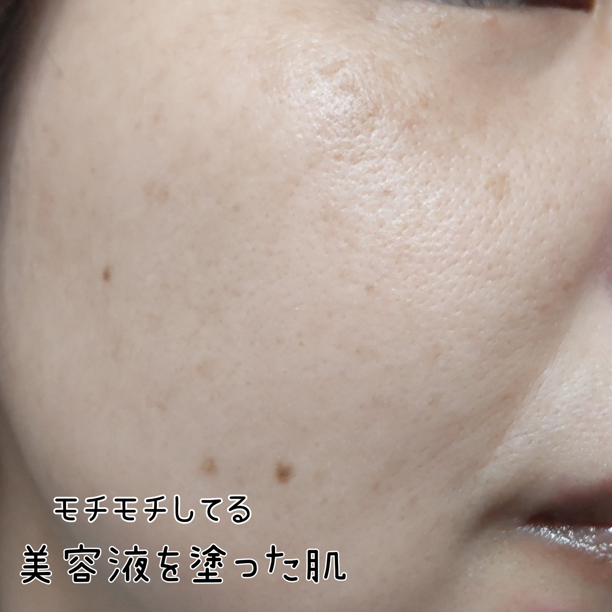 リペアブライトエッセンスDR 薬用美白美容液/コラージュリペア/美容液を使ったクチコミ（3枚目）