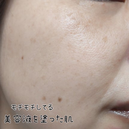 リペアブライトエッセンスDR 薬用美白美容液/コラージュ/美容液を使ったクチコミ(3枚目)