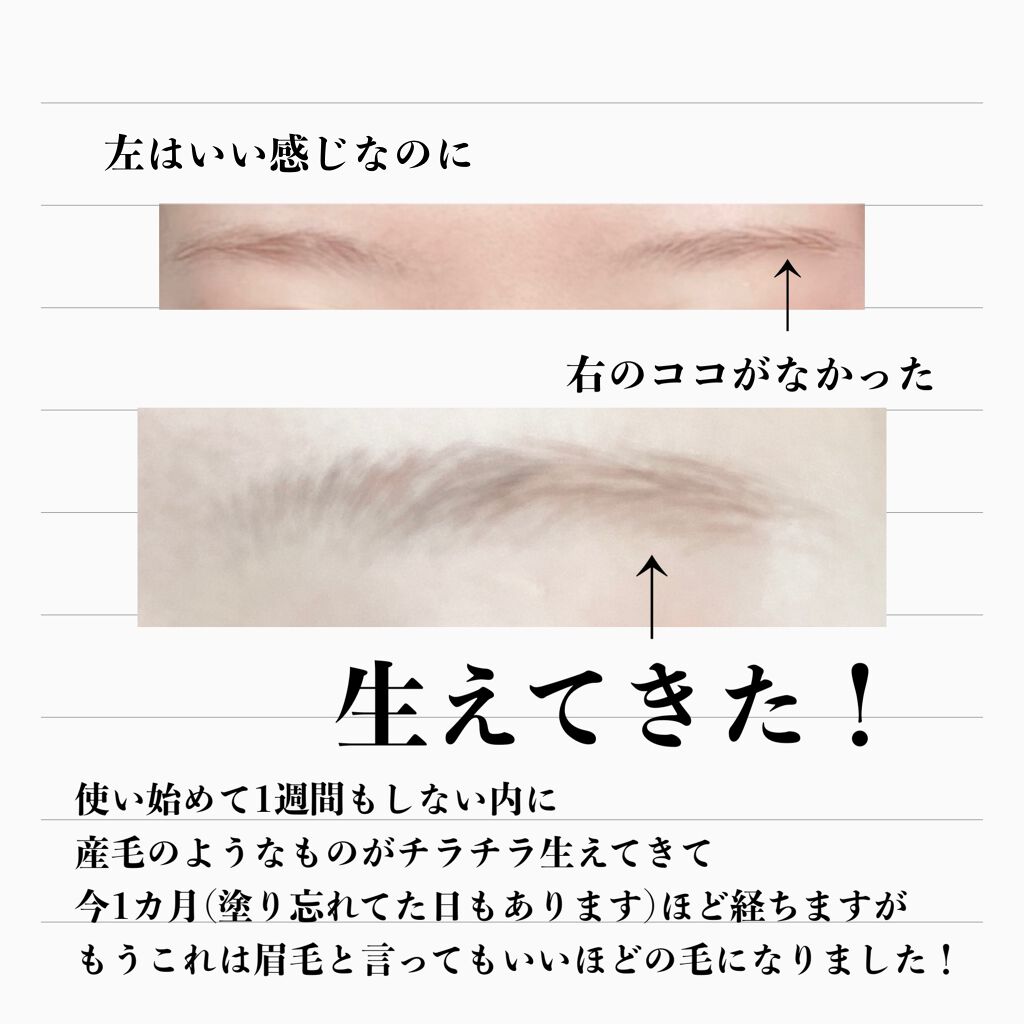 EMAKED（エマーキット）/水橋保寿堂製薬/まつげ美容液を使ったクチコミ（2枚目）