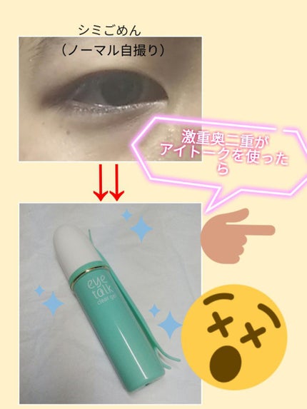 アイトーク クリアジェル/アイトーク/二重まぶた用アイテムを使ったクチコミ(1枚目)