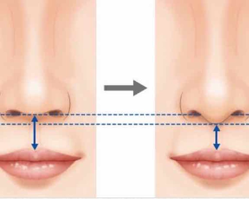 ニベアクリーム/ニベア/ボディクリームを使ったクチコミ（2枚目）