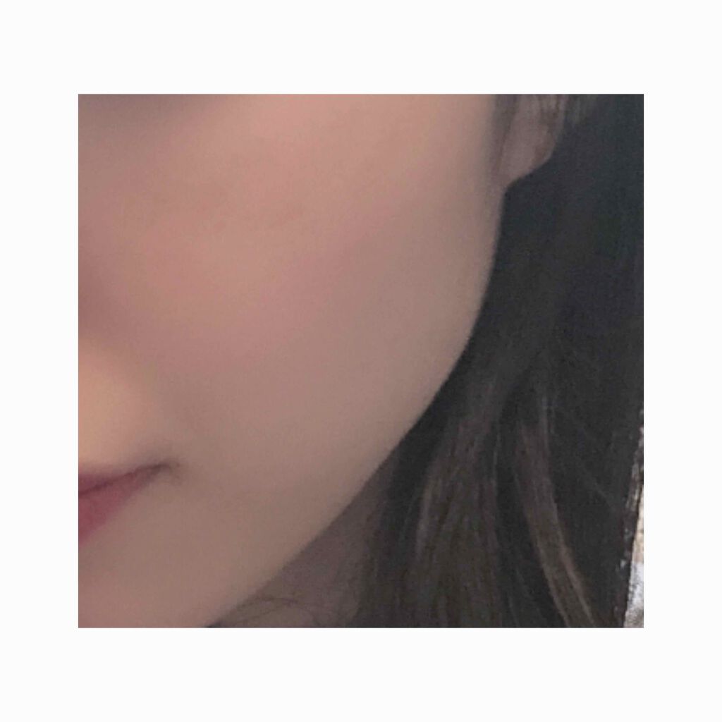 ハトムギ化粧水(ナチュリエ スキンコンディショナー R )/ナチュリエ/化粧水を使ったクチコミ(1枚目)