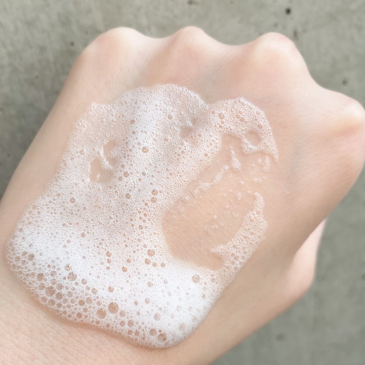 フェルゼアプレミアム 薬用泡の化粧水/フェルゼア/化粧水を使ったクチコミ(3枚目)