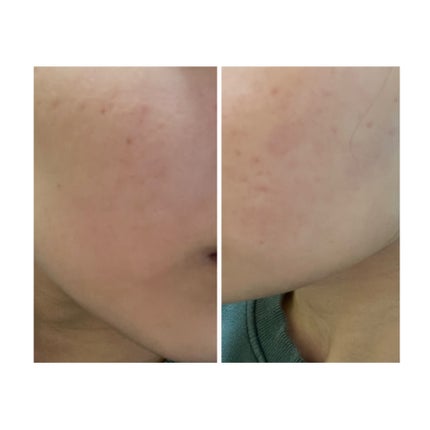 を使ったクチコミ(3枚目)