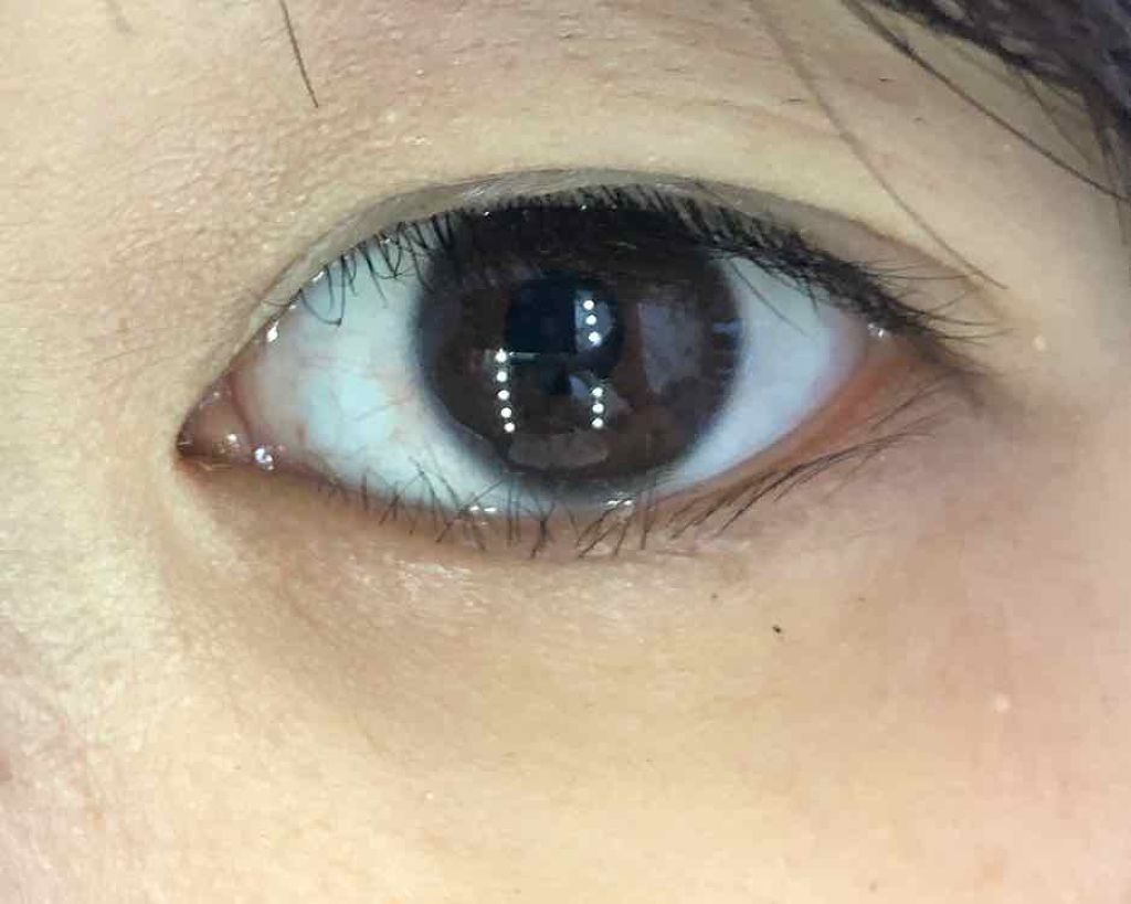 ひとえ・奥ぶたえ用カーラー/アイプチ®/ビューラーを使ったクチコミ(2枚目)