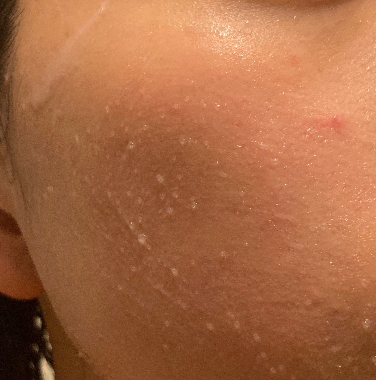 ピンクティーツリーライスシカウォッシュオフパック/APLIN/洗い流すパック・マスクを使ったクチコミ(3枚目)