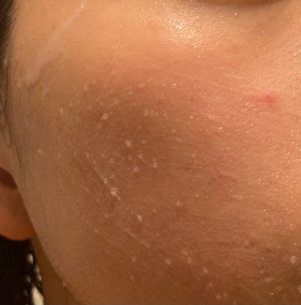 ピンクティーツリーライスシカウォッシュオフパック/APLIN/洗い流すパック・マスクを使ったクチコミ(3枚目)