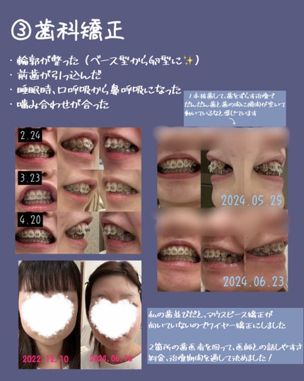 ラッシュジェリードロップ EX/MAJOLICA MAJORCA/まつげ美容液を使ったクチコミ(3枚目)