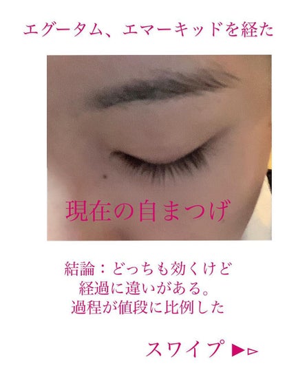 エグータム/アルマダスタイル/まつげ美容液を使ったクチコミ(2枚目)