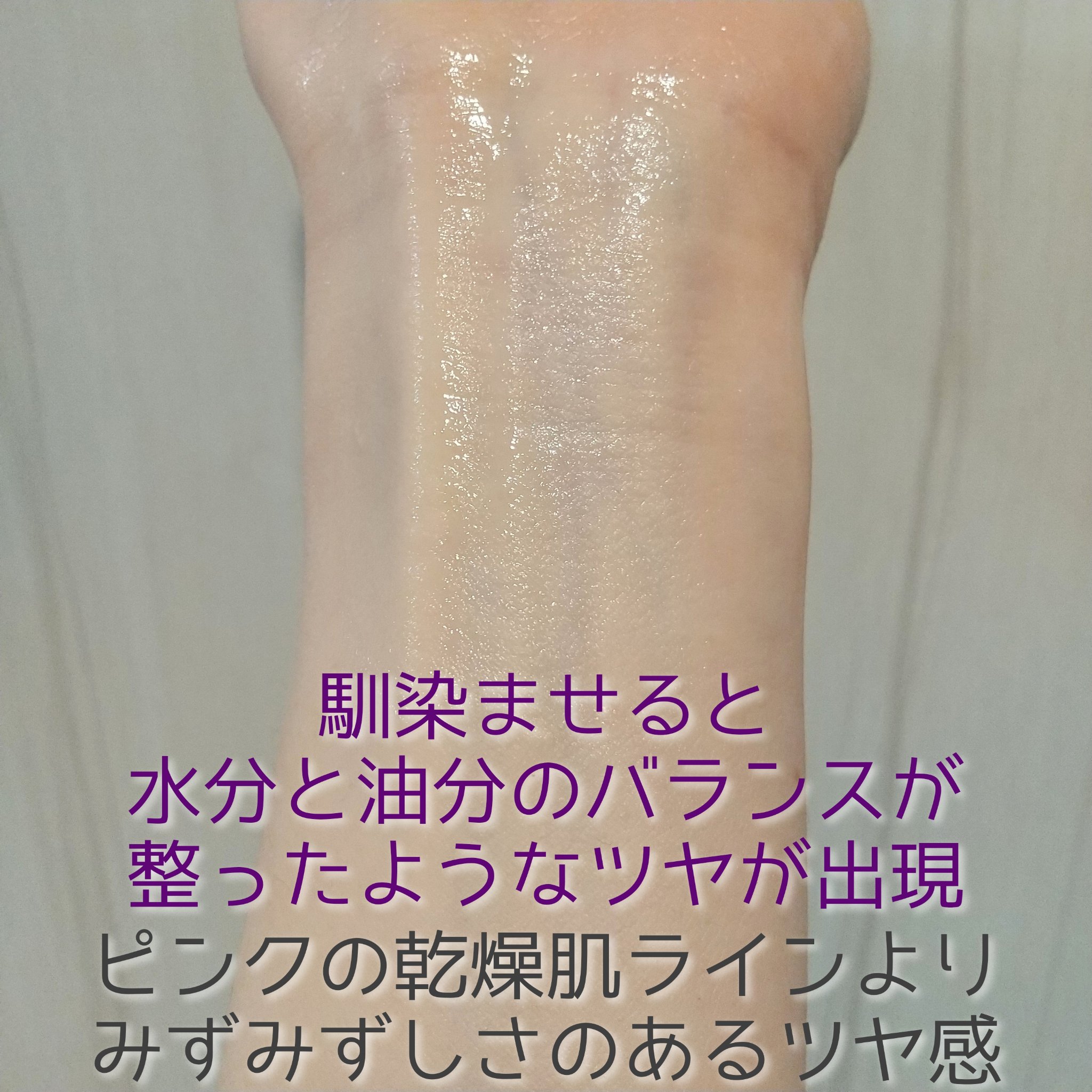 ミノン アミノモイスト 薬用アクネケア ミルク 100ｇ/ミノン/乳液を使ったクチコミ（3枚目）