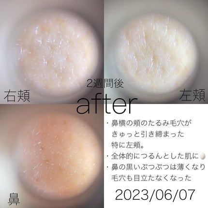 シカレチA エッセンス0.1/VT/美容液を使ったクチコミ(4枚目)