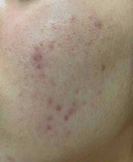 Cセラム/b.glen/美容液を使ったクチコミ(3枚目)