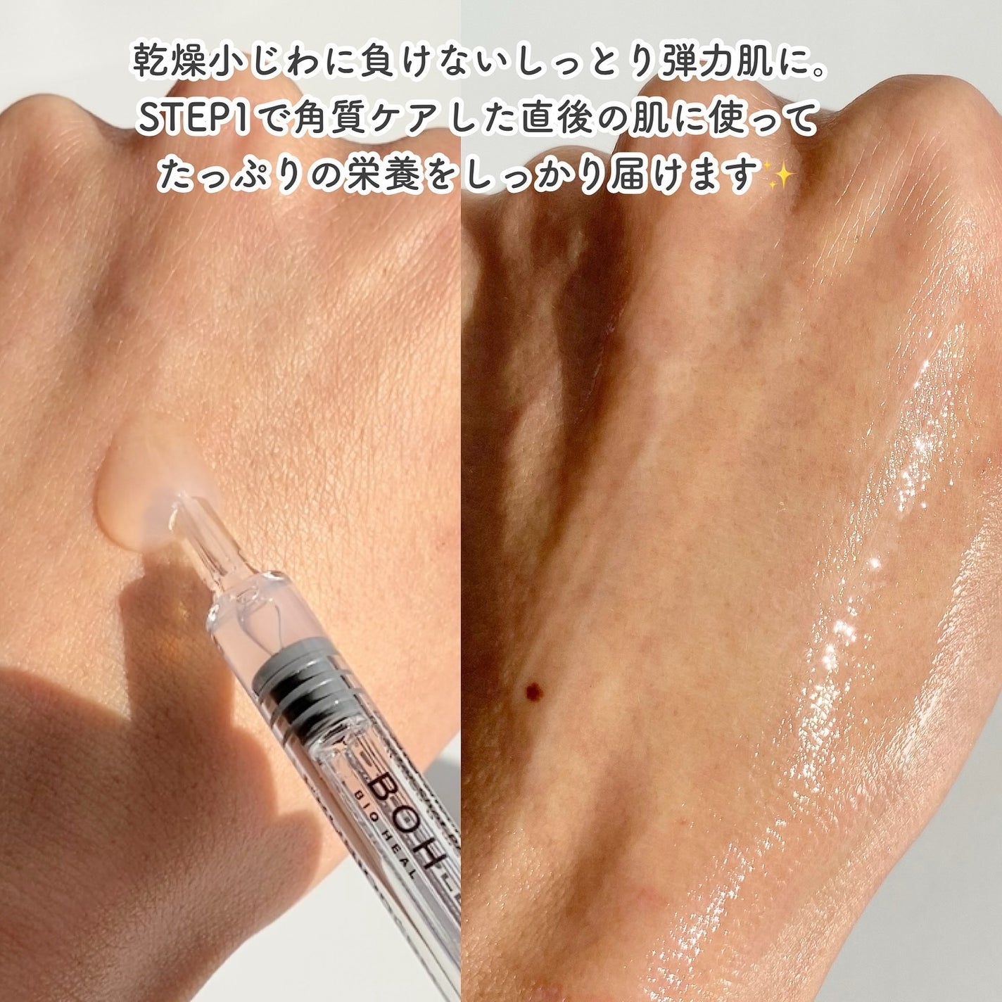 バイオヒールボ プロバイオダーム 3Dリフティングクリーム/BIOHEAL BOH/フェイスクリームを使ったクチコミ(6枚目)