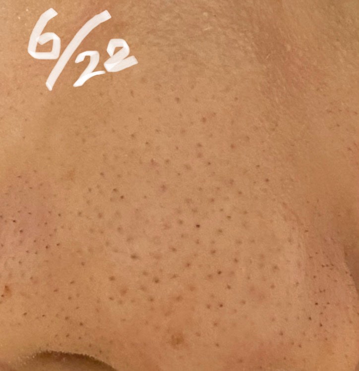 ビューティリフレッシャー/TWANY/その他洗顔料を使ったクチコミ(3枚目)