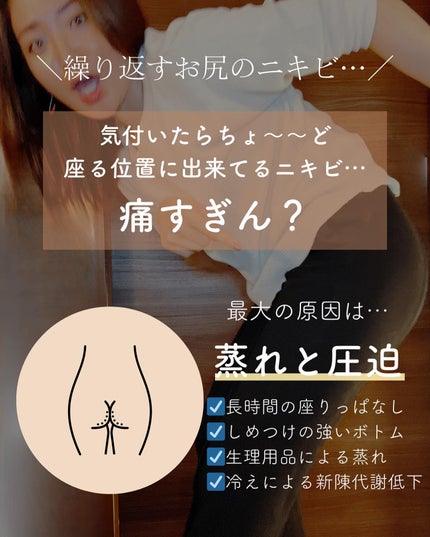 おゆみ|ニキビ・ニキビ跡ケア on LIPS 「@______ohyoume他の投稿はこちらから🙆♀️✨【誰..」(2枚目)