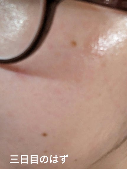 5番 白玉グルタチオンC美容液/numbuzin/美容液を使ったクチコミ(6枚目)