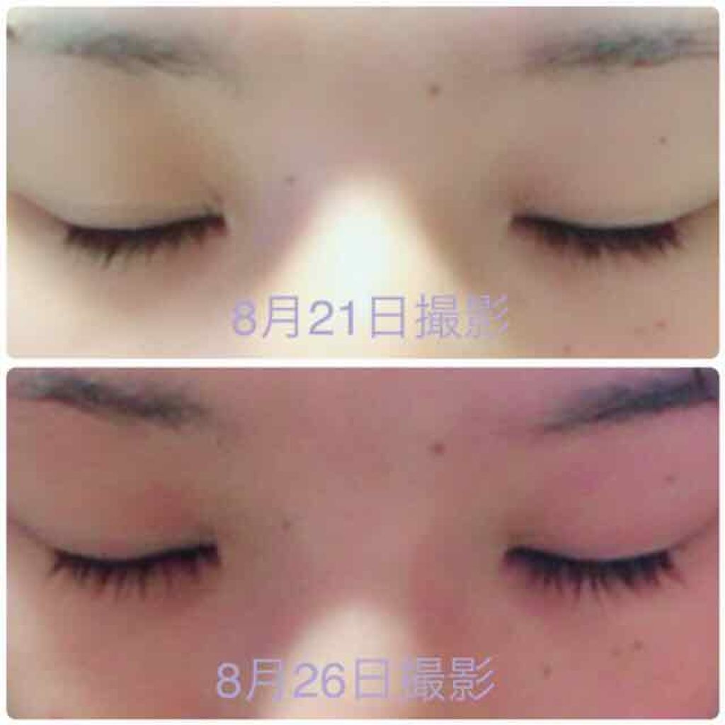 スカルプD ボーテ ピュアフリーアイラッシュセラム/アンファー(スカルプD)/まつげ美容液を使ったクチコミ（2枚目）