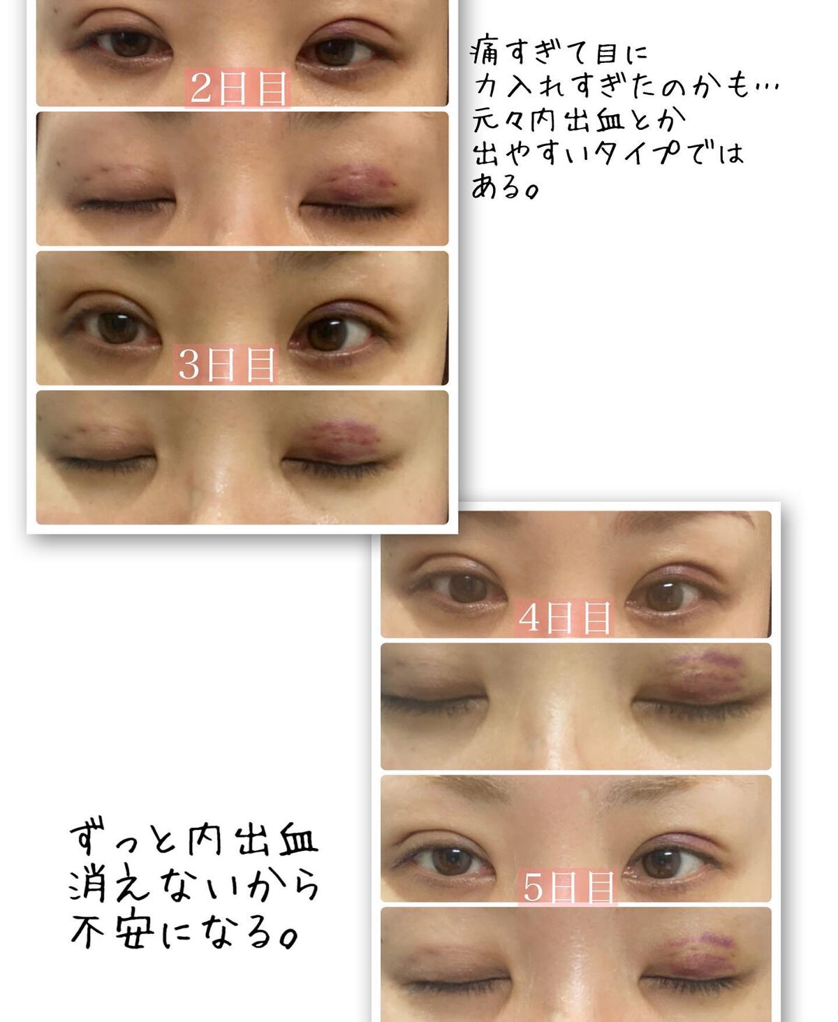 りっちゃん on LIPS 「土曜日の朝から目がたくさん出てきてすいません👀∞------..」(4枚目)