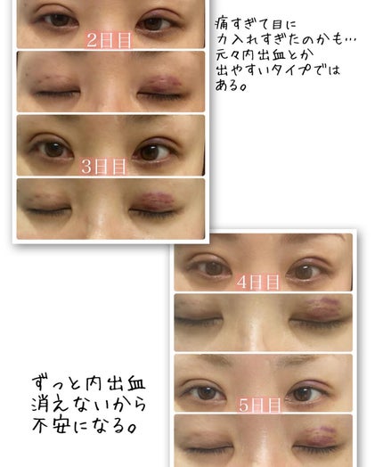 りっちゃん on LIPS 「土曜日の朝から目がたくさん出てきてすいません👀∞------..」(4枚目)