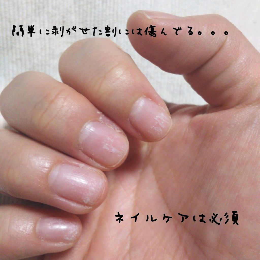 ウィークリージェル/HOMEI/ジェルネイルを使ったクチコミ(2枚目)