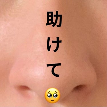 ﾋﾟ on LIPS 「緊急相談です、、2枚目の通り鼻の真ん中(？)って言うかでっぱり..」（1枚目）