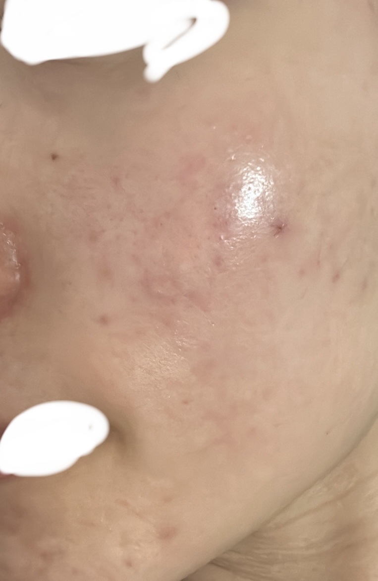 肌をうるおす保湿浸透水 バランシング/松山油脂/化粧水を使ったクチコミ（2枚目）