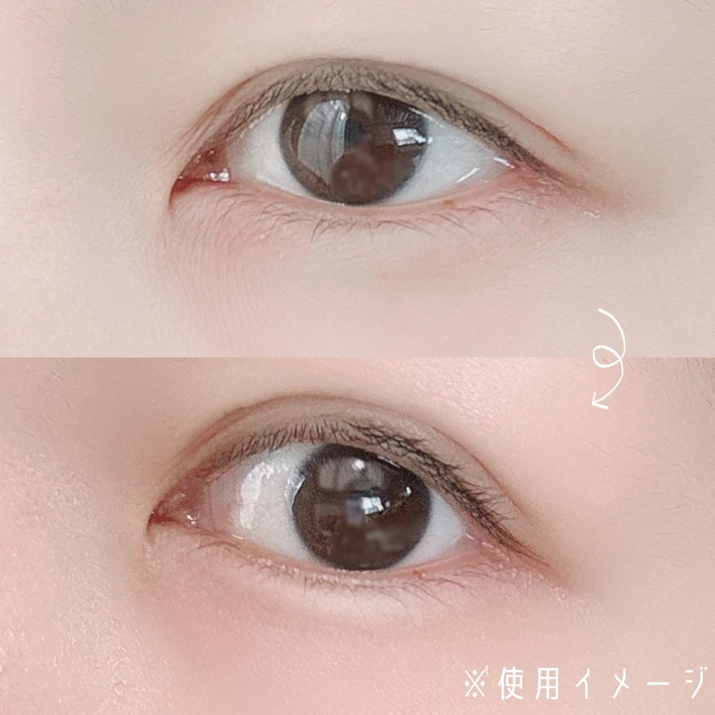 目元美顔器/ANLAN/美顔器・マッサージを使ったクチコミ(3枚目)