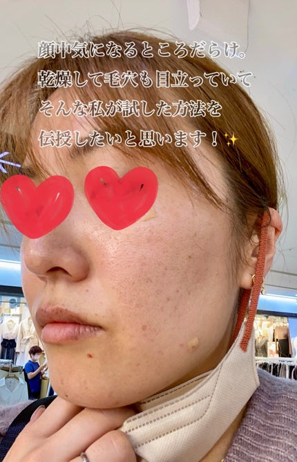 DHC ビタミンBミックス/DHC/美容サプリメントを使ったクチコミ(1枚目)