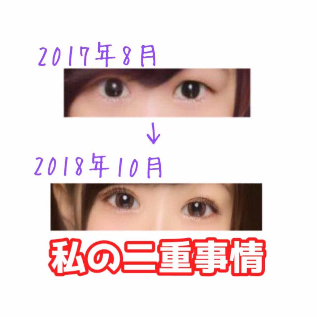 ニベアクリーム/ニベア/ボディクリームを使ったクチコミ（1枚目）